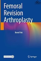 Femoral Revision Arthroplasty | آرتروپلاستی تجدید نظر استخوان ران
